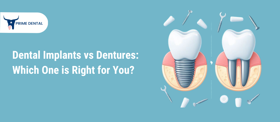 Dental Implants vs Dentures Which One is Right for You