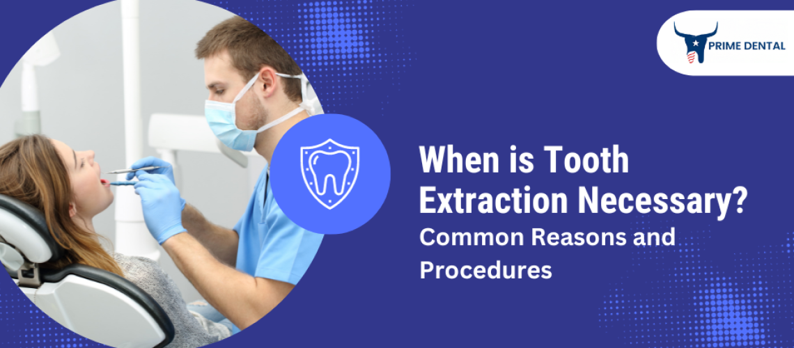 Tooth Extraction Necessary
